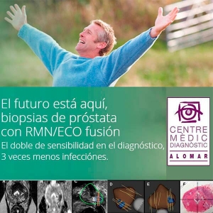 resonancia magnética