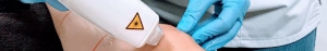 depilacion laser diodo
